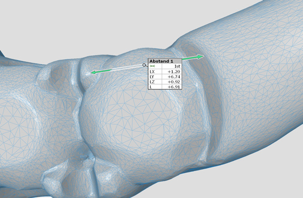 3D Scan Daten aus unterschiedlichen Positionen